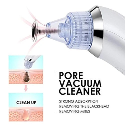 4 in 1 Vacuum Pore Cleaning Device